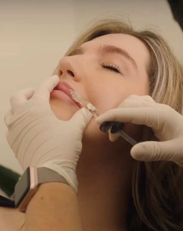 You are currently viewing Tips for Choosing the Right Lip Filler Specialist in Los Angeles!